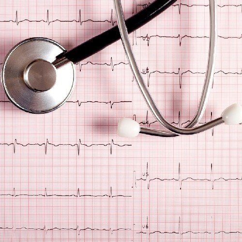 Consultație, EKG și Ecocardiograf