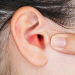 Mesare conduct auditiv extern