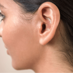 Excizia polipului auricular- urechea externă